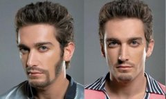 胡须种植会不会留下疤痕