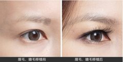 睫毛种植好不好呢