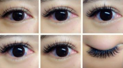 睫毛种植手术效果好不好