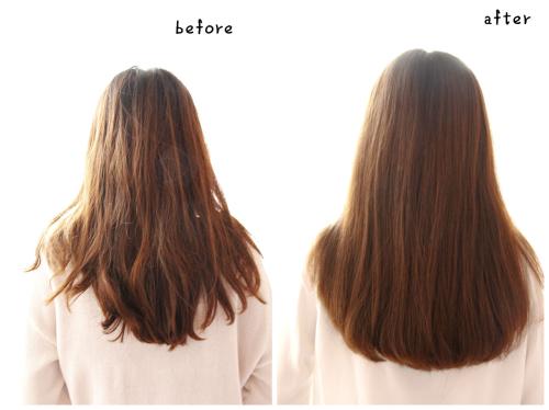 头发种植是多少钱？头发种植价格很贵吗？