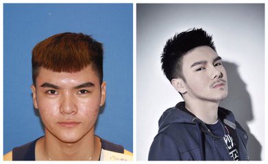 北京做胡须种植手术大概多少钱，效果如何？