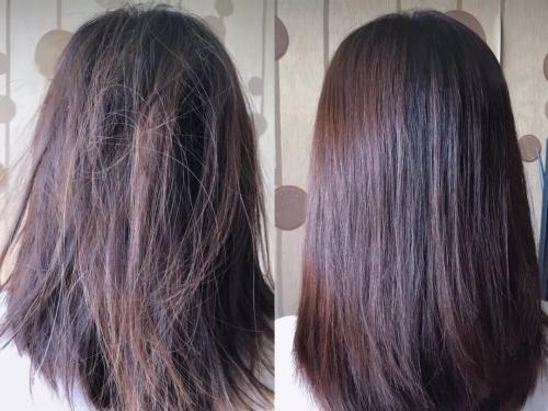 苏州头发种植手术做得好的医院有哪些，种植头发需要注意什么